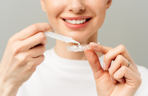 ホワイトニング