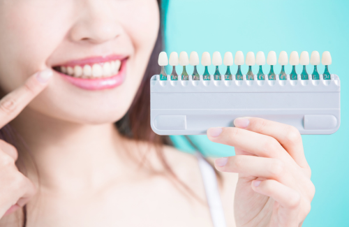 ホワイトニング