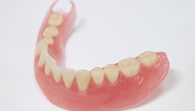 ノンクラスプデンチャー