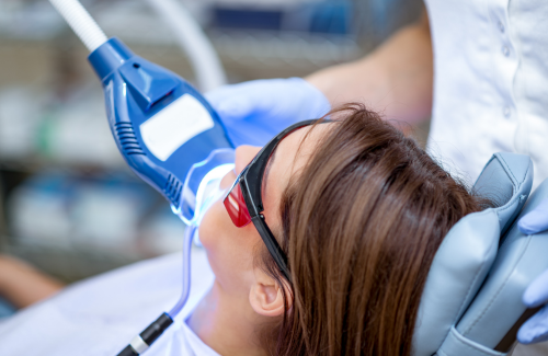 オフィスホワイトニング